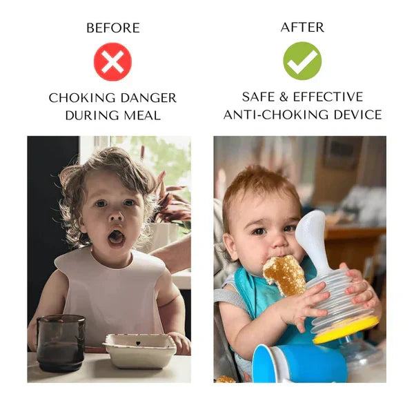 Anti-choking device helping restore normal breathing after choking incident